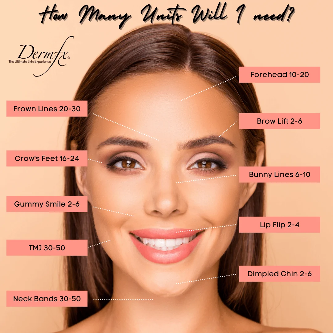 xeomin units in face diagram