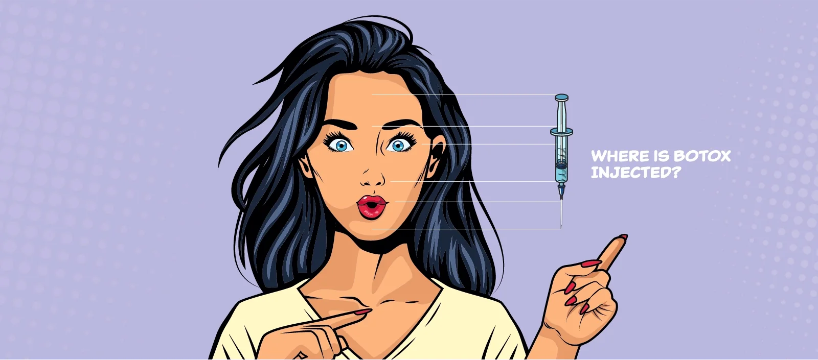 botox injection sites