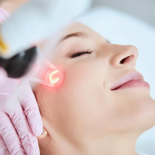 co2 laser resurfacing