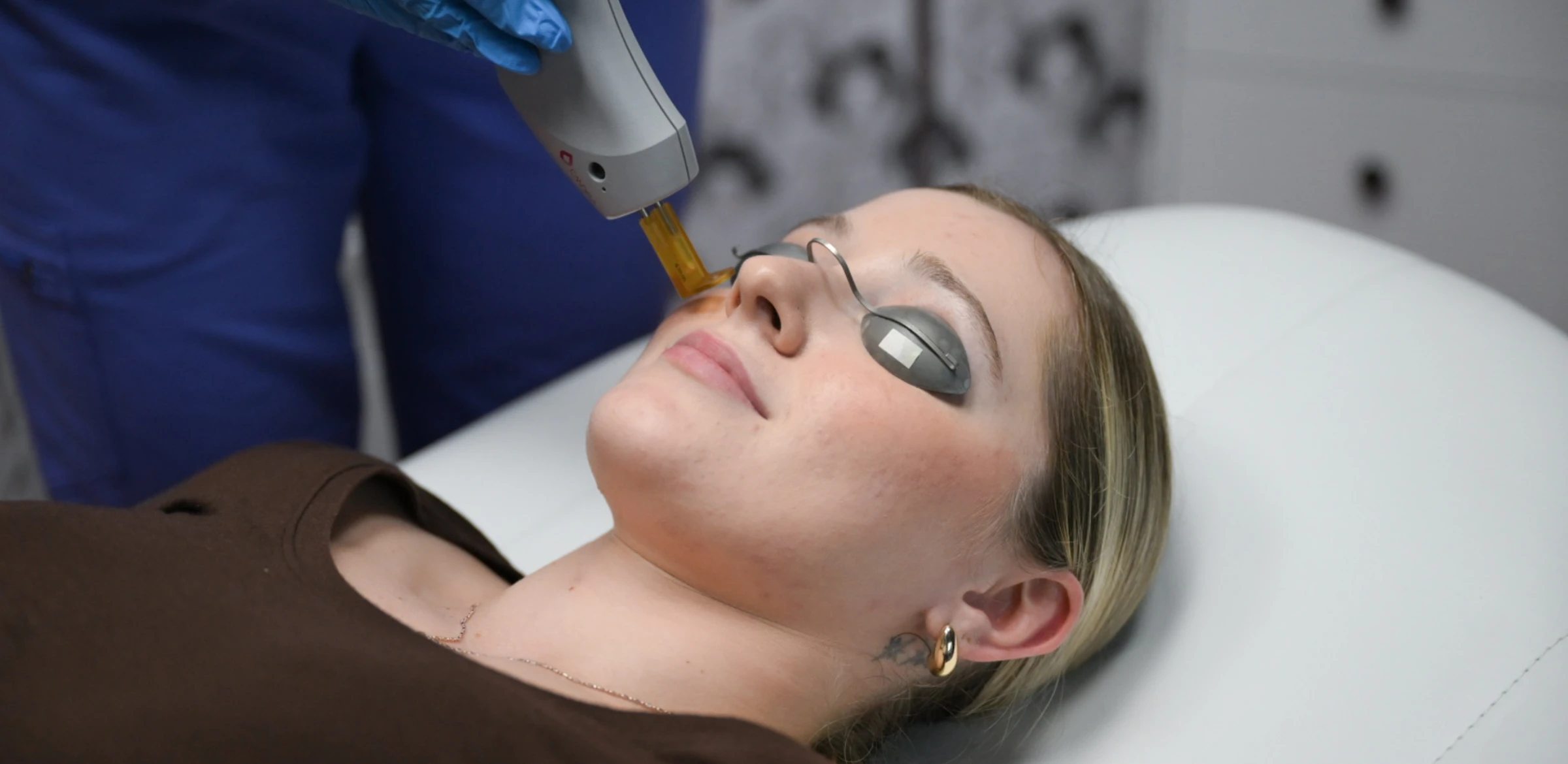 woman receiving smoothbeam laser treatment