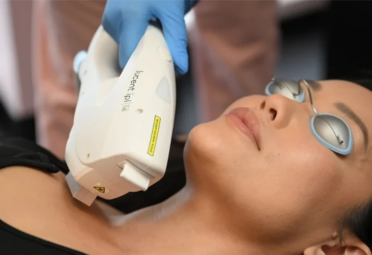 IPL treatment on client's chest