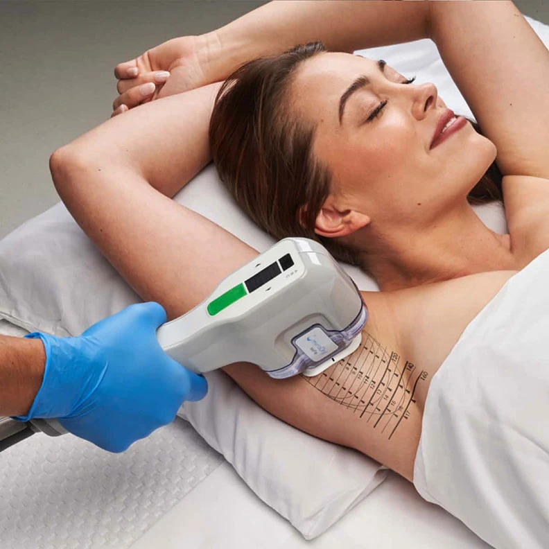 woman getting a miradry treatment