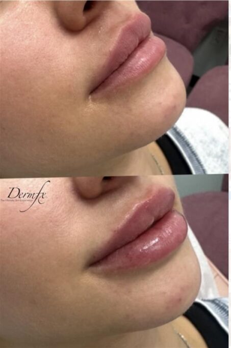 Case 4 before photo