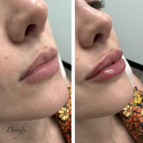 Case 14 before photo