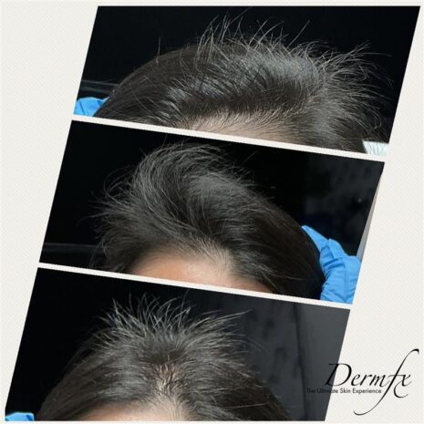 Case 3 before photo