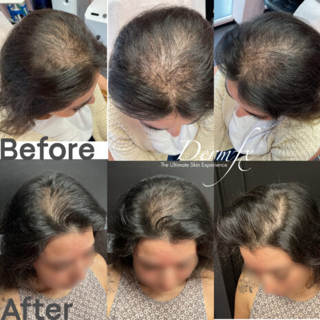 Case 4 before photo
