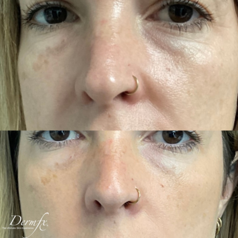 Case 4 before photo