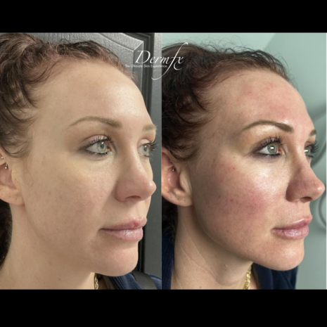 Case 4 before photo