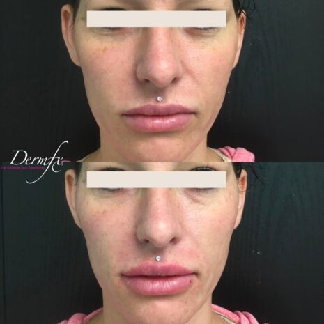 Case 7 before photo