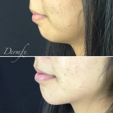 Case 4 before photo