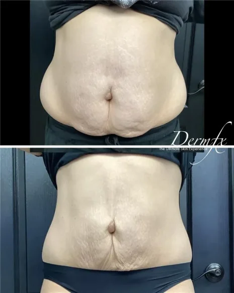 Case 16 before photo