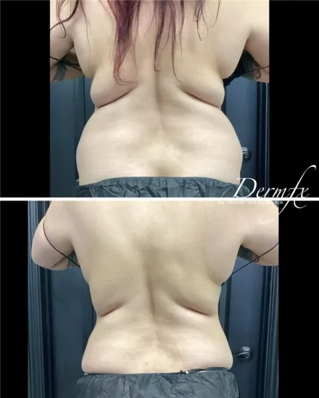 Case 17 before photo