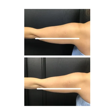 Case 21 before photo