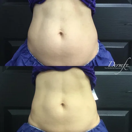 Case 24 before photo