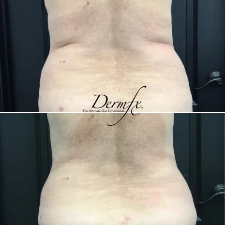Case 25 before photo