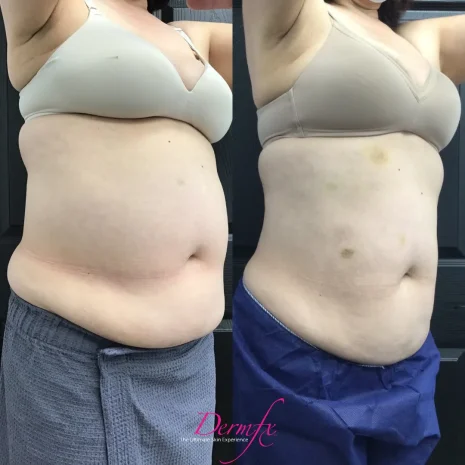 Case 27 before photo