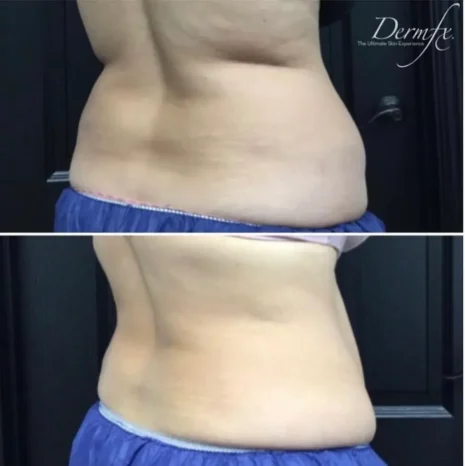 Case 28 before photo