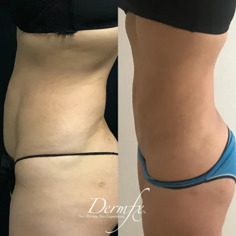 Case 2 after photo