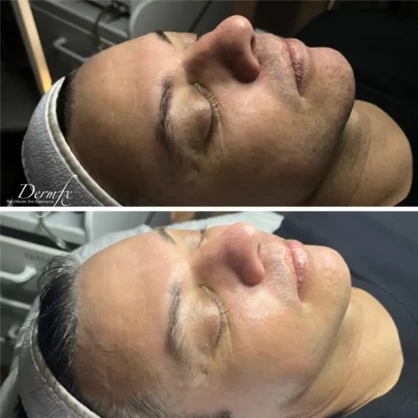 Case 4 before photo