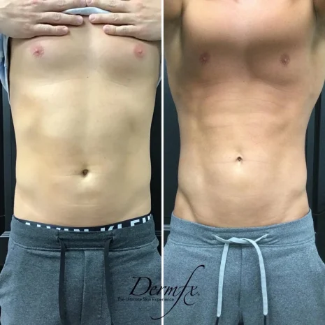 Case 4 before photo