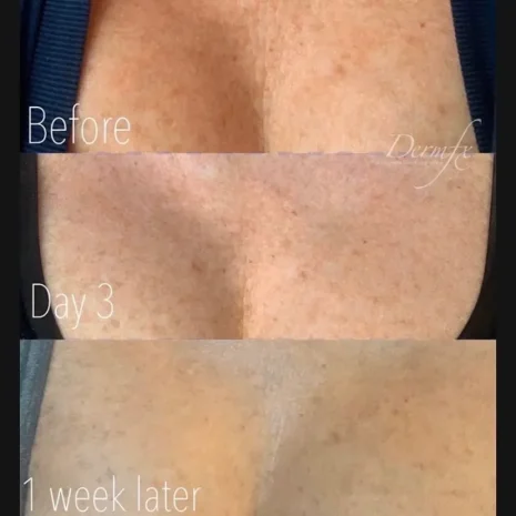 Case 4 before photo