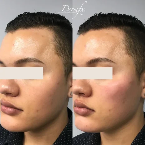 Case 3 before photo