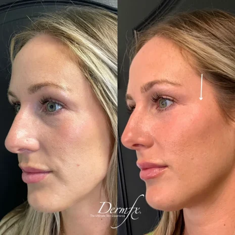 Case 4 before photo