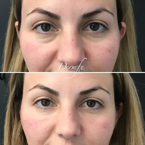 Case 4 before photo