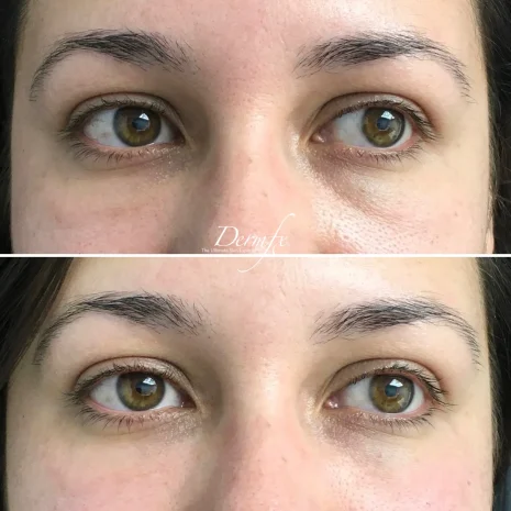Case 10 before photo