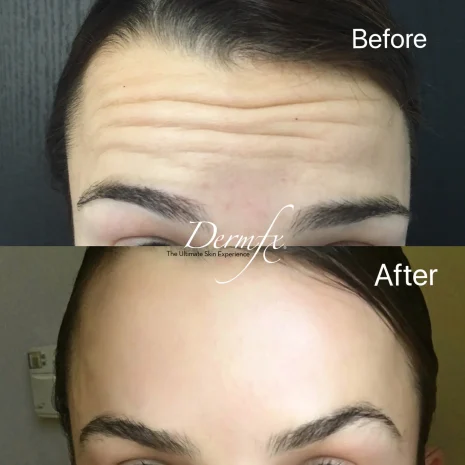 Case 7 before photo