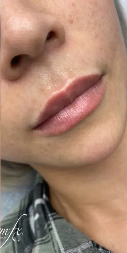 bna case