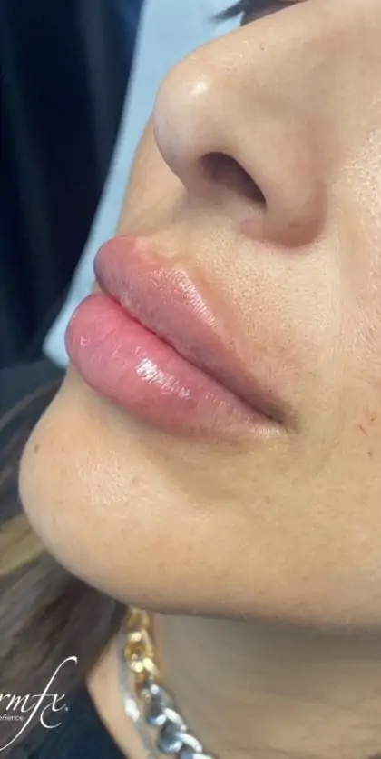 bna case