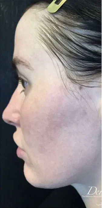 Case 1 before photo