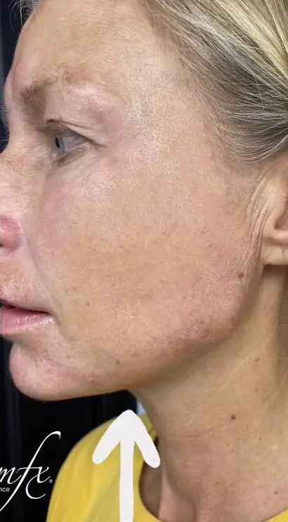 bna case