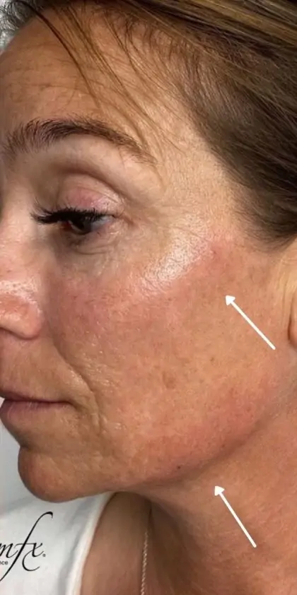 bna case