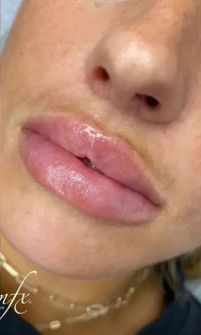 Case 19 after photo