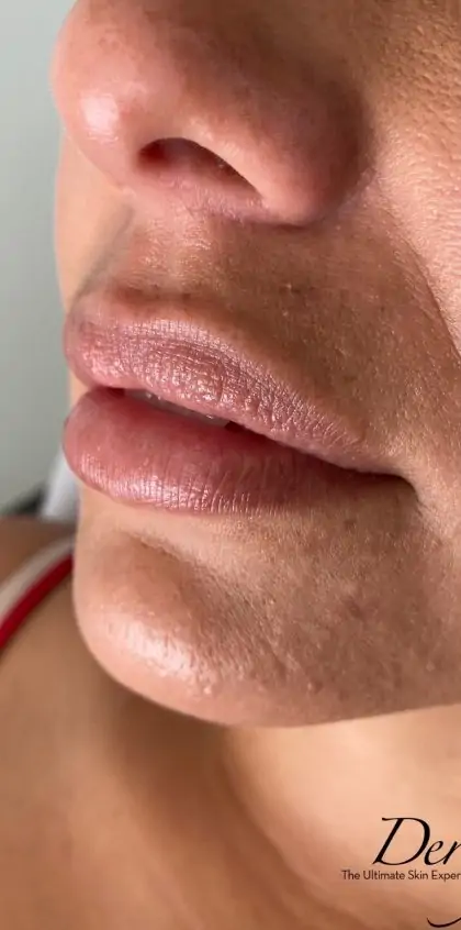bna case