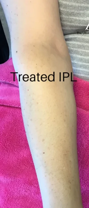Case 2 after photo
