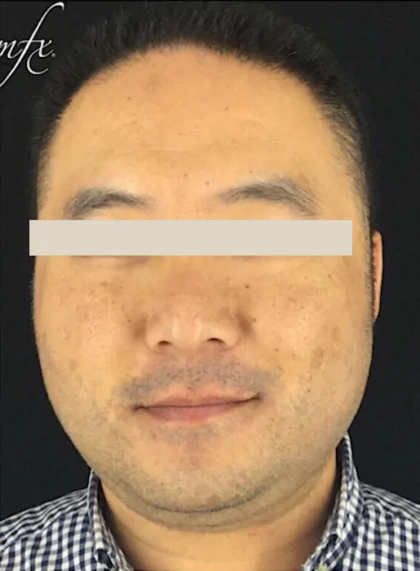 bna case