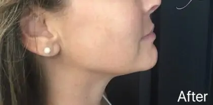 bna case