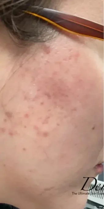 Case 4 before photo