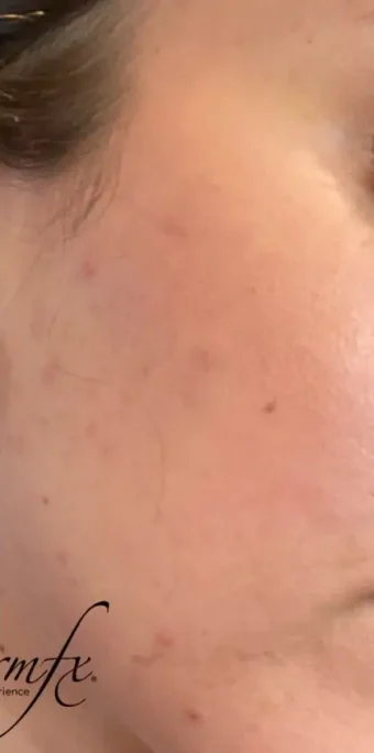 Case 4 after photo