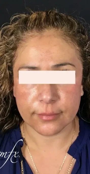Case 1 after photo