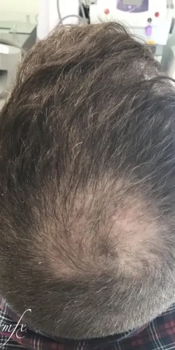 Case 1 after photo