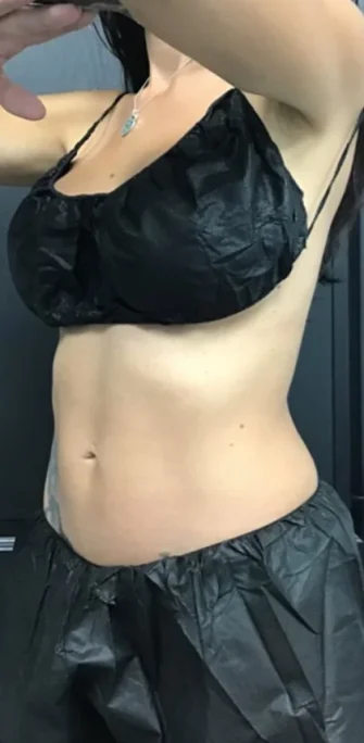 Case 1 after photo