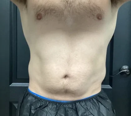 Case 12 before photo
