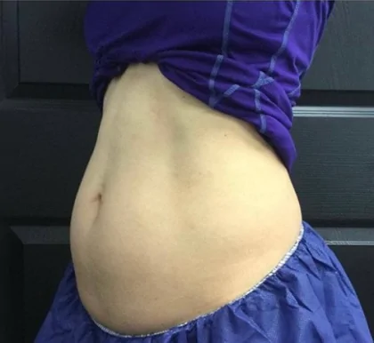 bna case