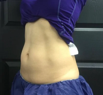 bna case