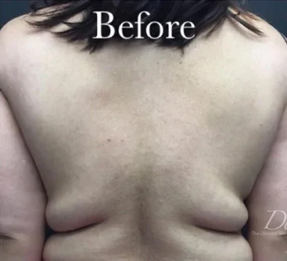 Case 5 before photo