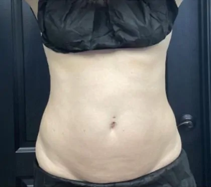 bna case
